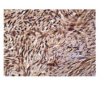 Rho D Antibody (H-6) - Immunohistochemistry - Image 160278 