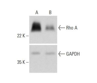 RhoA Antibody (26C4) - Western Blotting - Image 321853