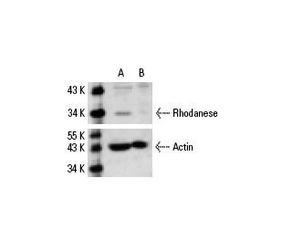 Rhodanese siRNA (h): sc-36418. Western blot analysis of Rhodanese expression in non-transfected control (A) and Rhodanese 
