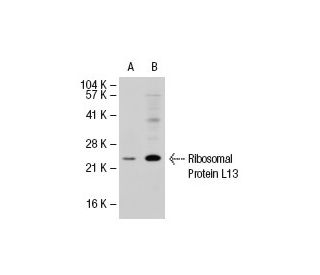 Ribosomal Protein L13 Antibody (SS-09) - Western Blotting - Image 32387 