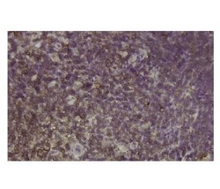 Ribosomal Protein L9 Antibody (ST-7) - Immunohistochemistry - Image 36177 