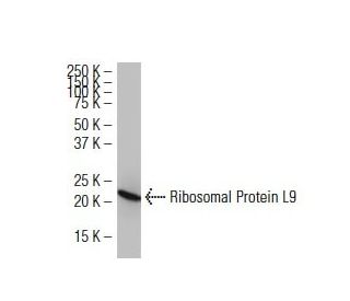 Ribosomal Protein L9 Antibody (ST-7) - Western Blotting - Image 34201