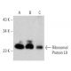 Ribosomal Protein L9 Antibody (ST-7) - Western Blotting - Image 368592 