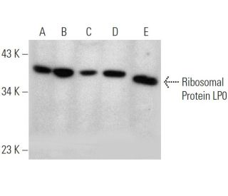 Ribosomal Protein LP0 Antibody (1B4) - Western Blotting - Image 368242 