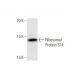 Ribosomal Protein S14 Antibody (3G5) - Western Blotting - Image 352140 