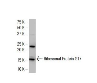Ribosomal Protein S17 Antibody (40-K) - Western Blotting - Image 34208 