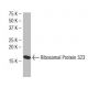 Ribosomal Protein S23 Antibody (SJ-K2) - Western Blotting - Image 34210 
