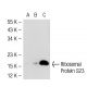 Ribosomal Protein S23 Antibody (SJ-K2) - Western Blotting - Image 52125