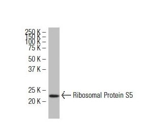 Ribosomal Protein S5 Antibody (464-J) - Western Blotting - Image 34205 