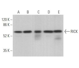 RICK Antibody (A-10) - Western Blotting - Image 373917 