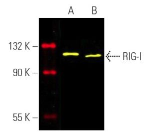 RIG-I Antibody (D-12) - Western Blotting - Image 391070The Double Nickase Plasmid features a U6 promoter for sgRNA expression, a 20 nt targeting sequence, and a gRNA scaffold to guide Cas9n. It includes a CBh promoter for Cas9n (D10A) and puromycin resistance, GFP for transfection verification, and nuclear localization signals (NLS). The 2A peptide allows co-expression of Cas9n and Puro from a single promoter, enabling precise genome editing with reduced off-target effects.