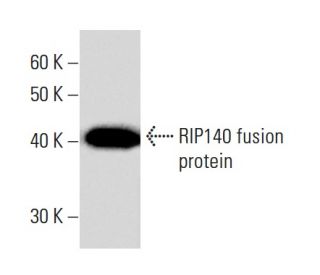 RIP140 Antibody (2656C6a) - Western Blotting - Image 16469 