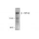 RIP140 Antibody (2656C6a) - Western Blotting - Image 384247