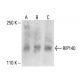 RIP140 Antibody (F-2) - Western Blotting - Image 404798