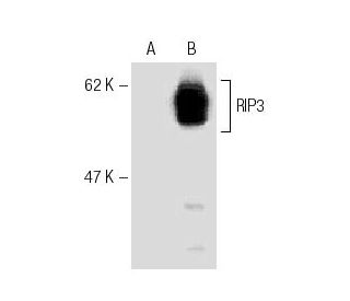 RIP3 Antibody (Rippy-3) - Western Blotting - Image 67454