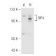 RIP4 Antibody (387.1) - Western Blotting - Image 65530