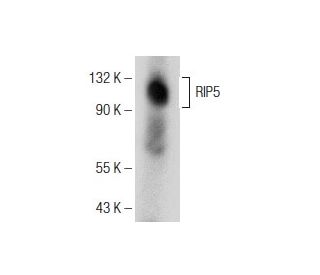 RIP5 Antibody (E-6) - Western Blotting - Image 151040 