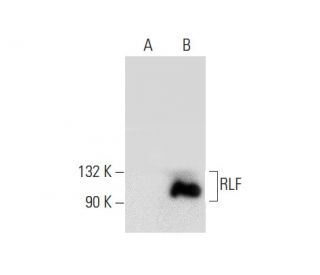 RLF Antibody (D-7) - Western Blotting - Image 139276Each CRISPR/Cas9 Knockout (KO) Plasmid product consists of a pool of 3 plasmids designed to ensure identification and cleavage of a specific gene for maximum knockout efficiency. Each plasmid encodes a unique 20 nt sequence derived from the GeCKO (v2) library.
