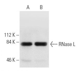 RNase L Antibody (2E9.2G5) - Western Blotting - Image 8670 