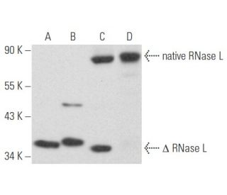 RNase L Antibody (E-9) - Western Blotting - Image 355795Each CRISPR/Cas9 Knockout (KO) Plasmid product consists of a pool of 3 plasmids designed to ensure identification and cleavage of a specific gene for maximum knockout efficiency. Each plasmid encodes a unique 20 nt sequence derived from the GeCKO (v2) library.