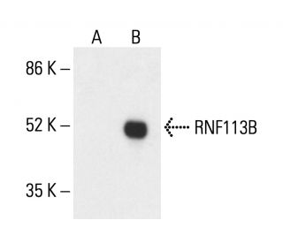 RNF113B Antibody (A-4) - Western Blotting - Image 411151 
