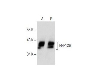 RNF126 Antibody (C-1) - Western Blotting - Image 151715 