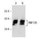 RNF126 Antibody (C-1) - Western Blotting - Image 151715 