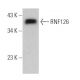 RNF126 Antibody (C-1) - Western Blotting - Image 364683