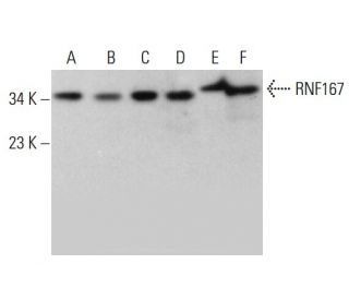 RNF167 Antibody (E-9) - Western Blotting - Image 376664 