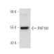 RNF168 Antibody (B-11) - Western Blotting - Image 32386 