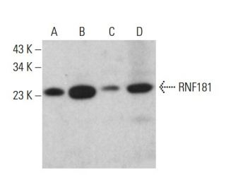 RNF181 Antibody (F-2) - Western Blotting - Image 382583 