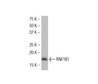 RNF181 Antibody (F-9E) - Western Blotting - Image 34482 