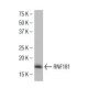 RNF181 Antibody (F-9E) - Western Blotting - Image 34482 