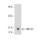 RNF181 Antibody (F-9E) - Western Blotting - Image 155198 