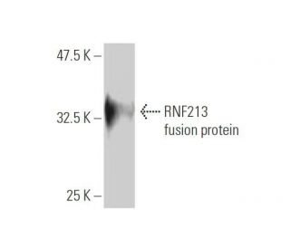 RNF213 Antibody (5C12) - Western Blotting - Image 350253