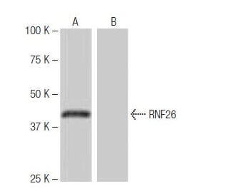 RNF26 Antibody (1-RE42) - Western Blotting - Image 65044