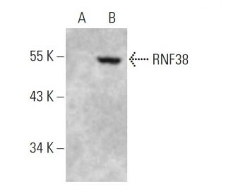 RNF38 Antibody (E-7) - Western Blotting - Image 396374 