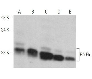 RNF5 Antibody (22B3) - Western Blotting - Image 359357 