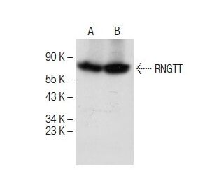 RNGTT Antibody (D-3) - Western Blotting - Image 284987