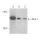 Rock-1 Antibody (H-11) - Western Blotting - Image 354005 