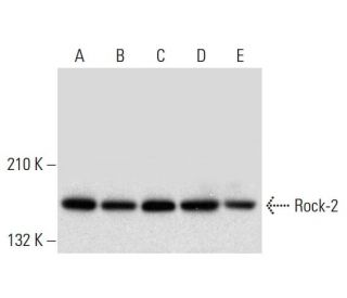 Rock-2 Antibody (D-11) - Western Blotting - Image 305692 