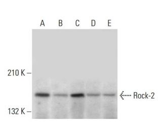 Rock-2 Antibody (D-2) - Western Blotting - Image 305691 