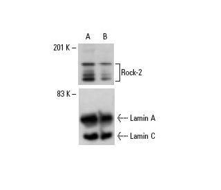 Rock-2 siRNA (h): sc-29474. Western blot analysis of Rock-2 expression in non-transfected control (A) and Rock-2 siRNA tra 