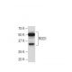 ROD1 Antibody (F-30) - Western Blotting - Image 34217 