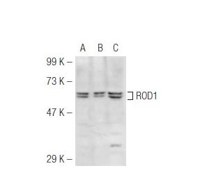 ROD1 Antibody (F-30) - Western Blotting - Image 47294