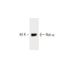 Ron &alpha; Antibody (29) - Western Blotting - Image 60434 
