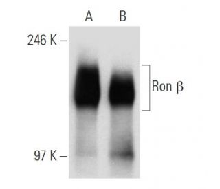 Ron &beta; Antibody (E-3) - Western Blotting - Image 30311 