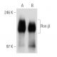 Ron β Antibody (E-3) - Western Blotting - Image 30311 