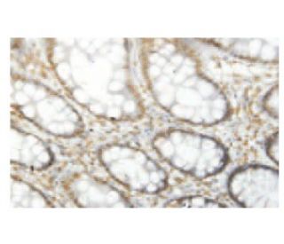 ROPN1 Antibody (IW.63) - Immunohistochemistry - Image 53955