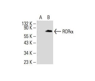 RORα Antibody (C-7) - Western Blotting - Image 393530Each CRISPR/Cas9 Knockout (KO) Plasmid product consists of a pool of 3 plasmids designed to ensure identification and cleavage of a specific gene for maximum knockout efficiency. Each plasmid encodes a unique 20 nt sequence derived from the GeCKO (v2) library.